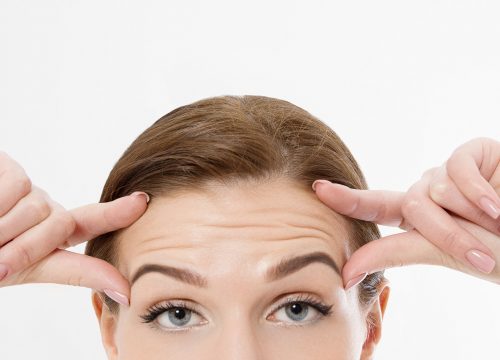 Photo of a woman with forehead wrinkles