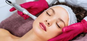 Microneedling with Vivace Ultra