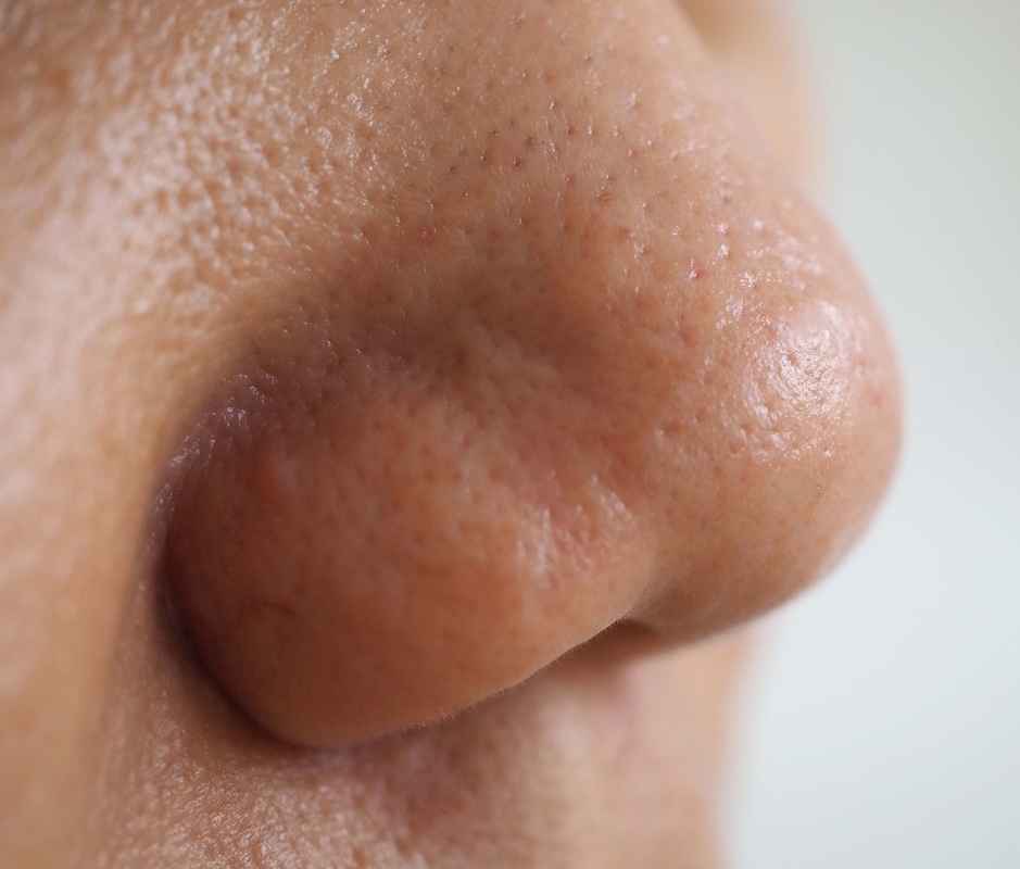 Large pores on a person's nose. Close-up photo.