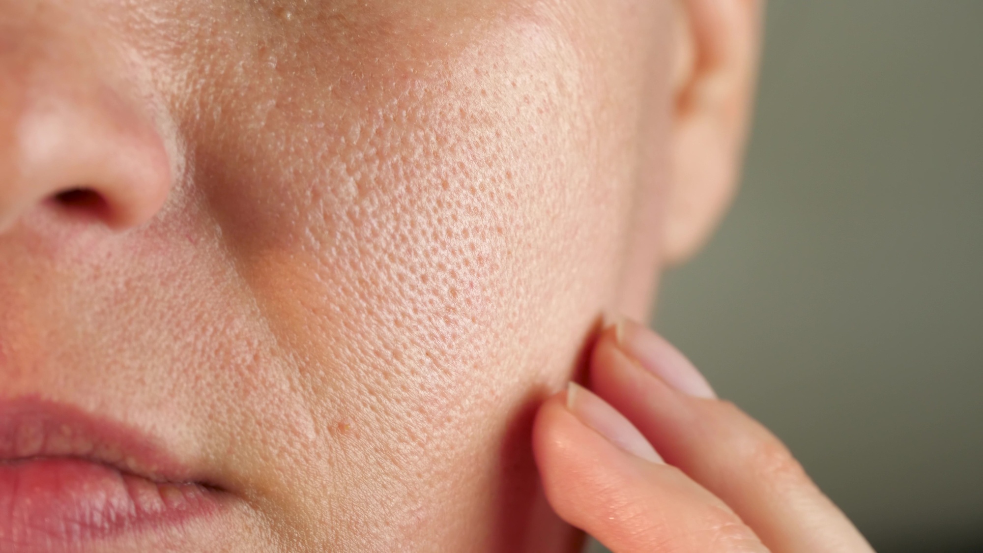 Problem skin with dilated and enlarged pores. Close-up of a woman's face.
