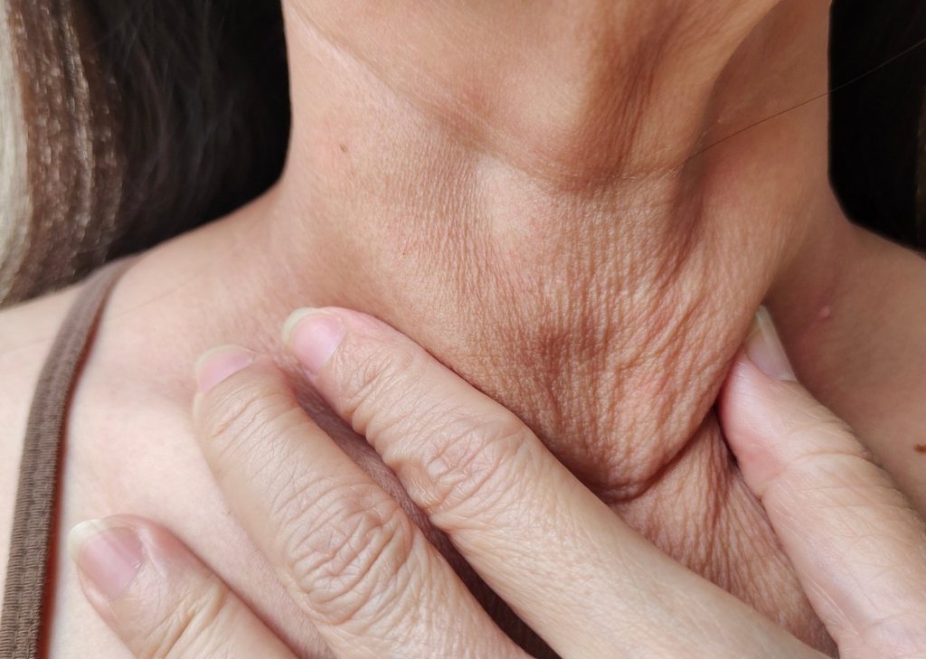 Photo of loose skin on a woman's neck