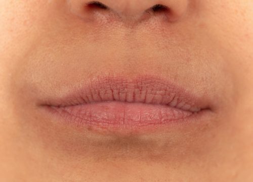 Close-up on a woman's thin lips