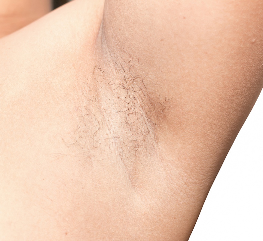 Armpit hair regeneration 