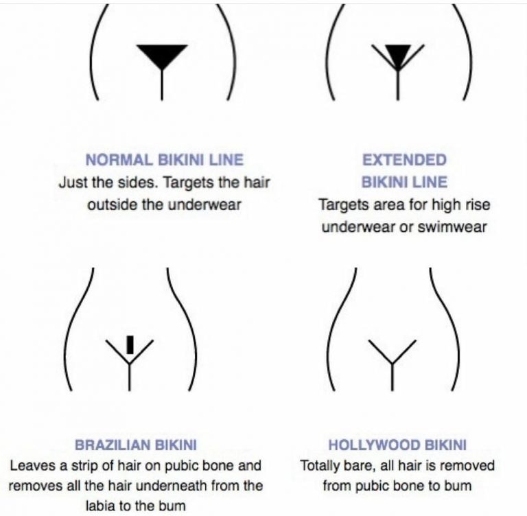 Graphic showing different bikini line styles, including normal, extended, Brazilian, and Hollywood.